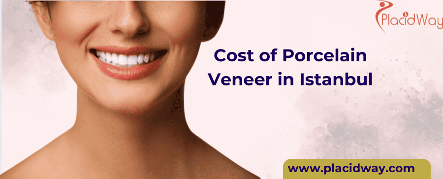 porcelain veneer in Istanbul