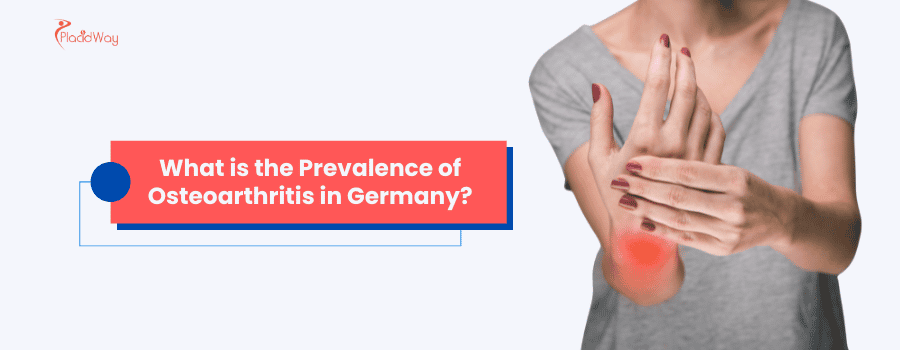 ¿Cuál es la prevalencia de la osteoartritis en Alemania?