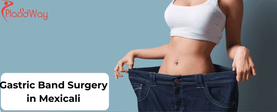 Gastric Band Surgery in Mexicali
