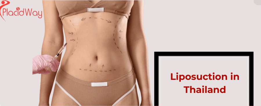 Liposuction in Thailand