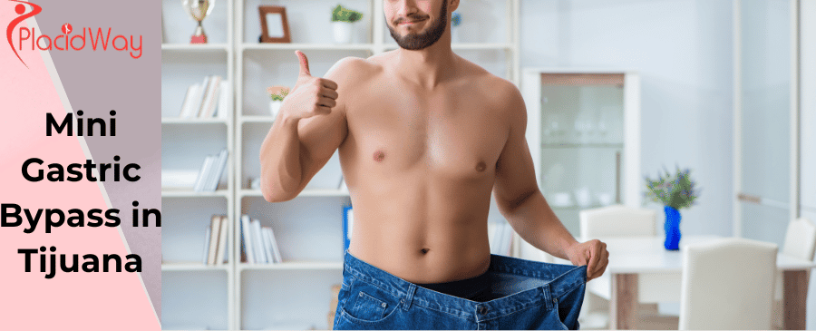 Mini Bypass Gástrico en Tijuana