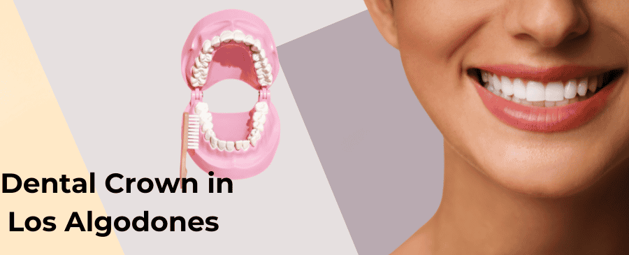 Corona dental en Los Algodones