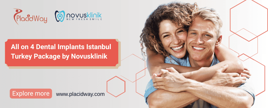 Paquete de implantes dentales All on 4 en Estambul, Turquía, de Novusklinik