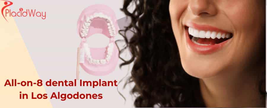 Implantes dentales All-on-8