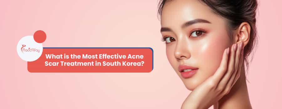 What is the Most Effective Acne Scar Treatment in South Korea?