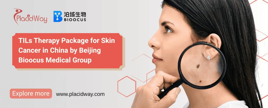 العلاج بالخلايا اللمفاوية المتسللة للورم لسرطان الجلد في الصين