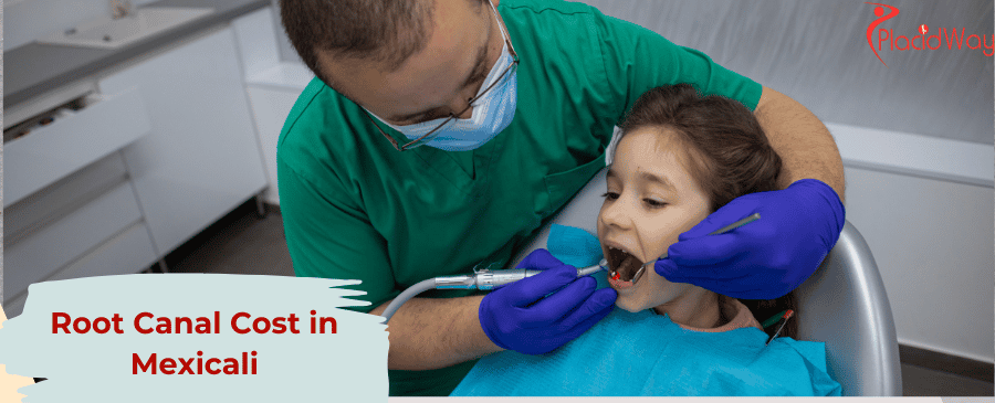 Root Canal Cost in Mexicali