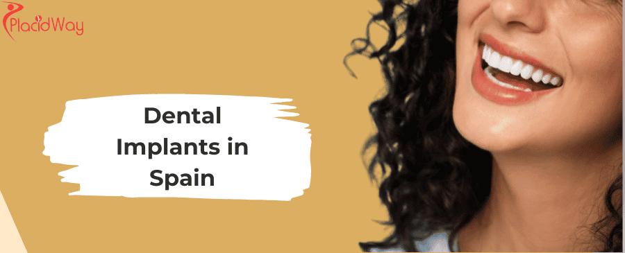 Implantes dentales en España
