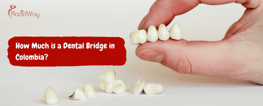 Dental Bridge in Colombia