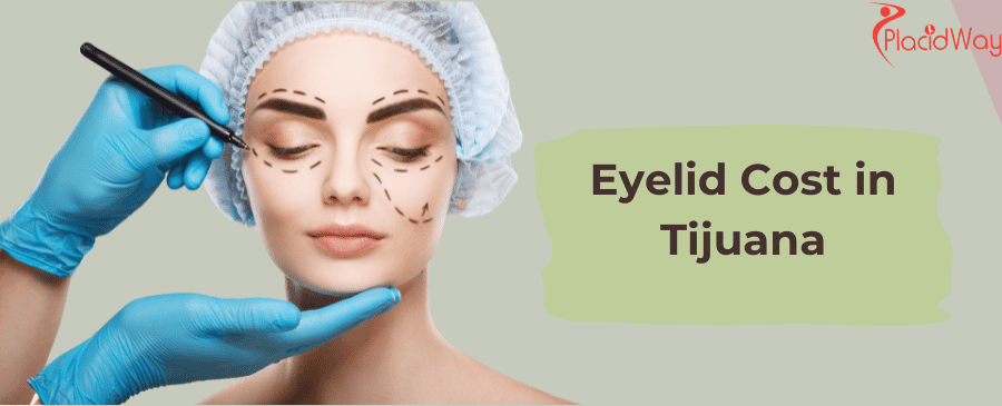 Costo de párpados en Tijuana
