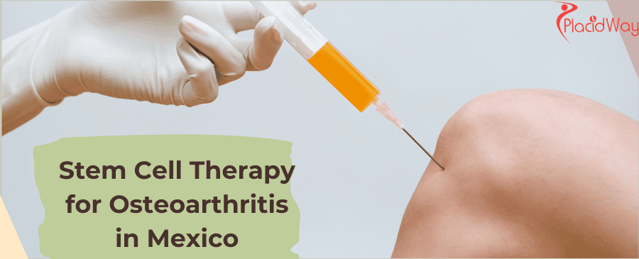 Terapia con células madre para la osteoartritis en México