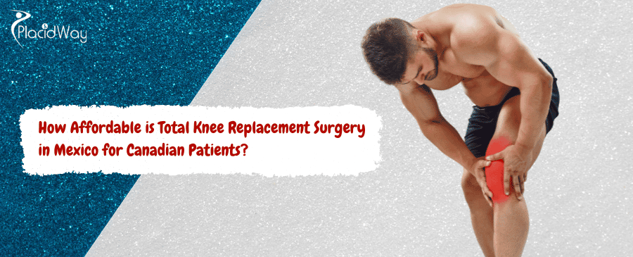 Total Knee Replacement Surgery in Mexico 