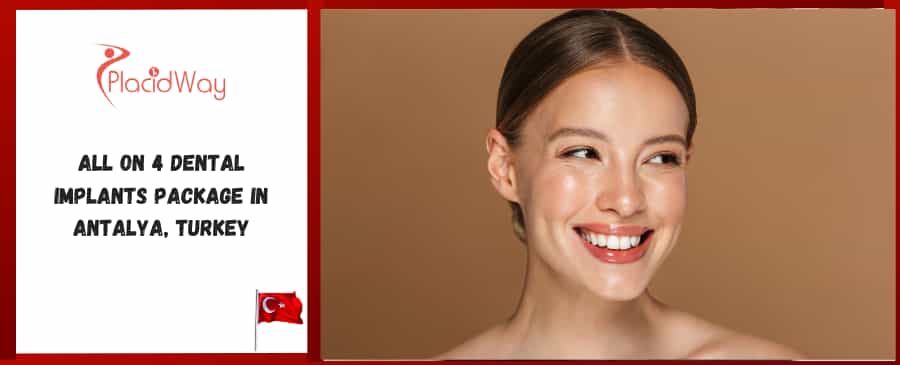 All on 4 Dental Implants Package in Antalya, Turkey