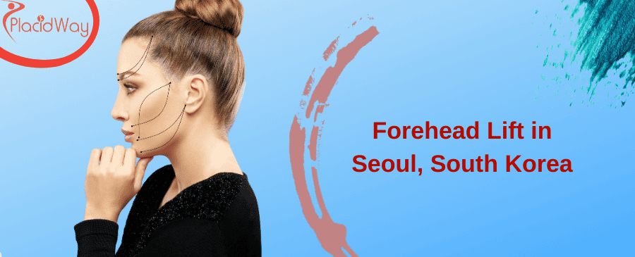 대한민국 서울에서 이마 리프팅 시술