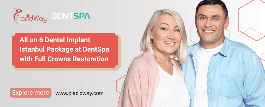 Paquete de implantes dentales All on 6 en Estambul en DentSpa