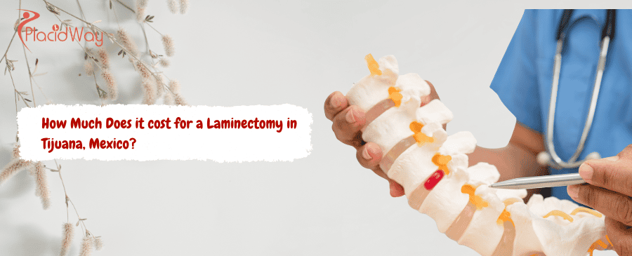 Laminectomy in Tijuana, Mexico