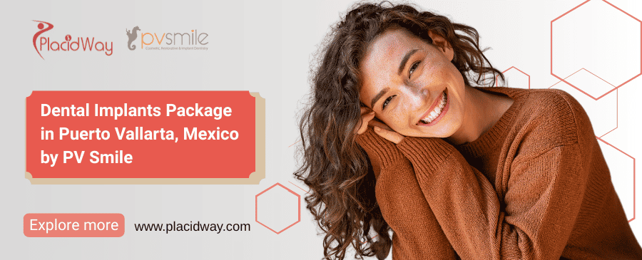 Puerto Vallarta Dental Implants PV Smile Offer