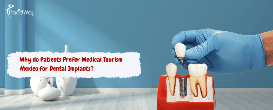 Medical Tourism Mexico for Dental Implants