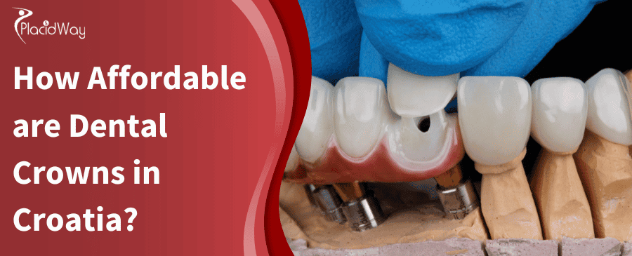 How Affordable Are Dental Crowns In Croatia