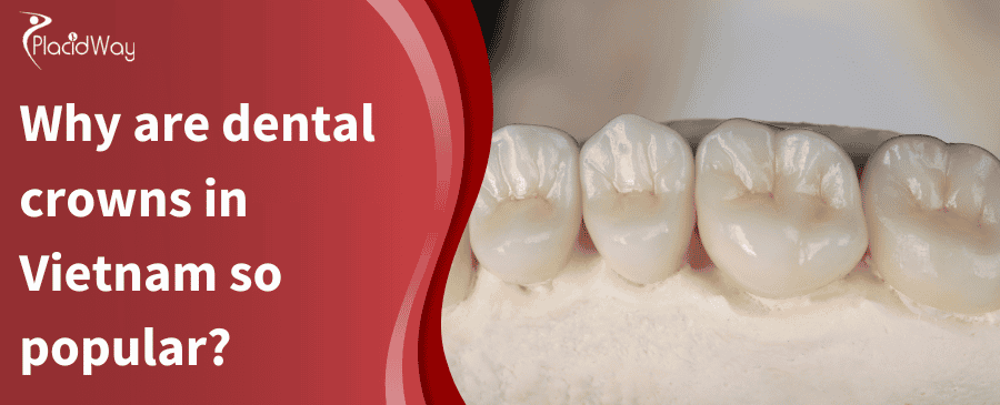 Why Are Dental Crowns In Vietnam So Popular
