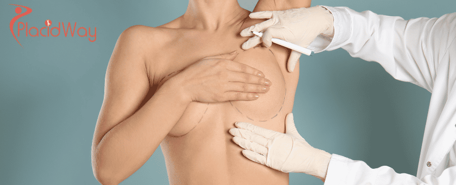 breast augmentation in mexico