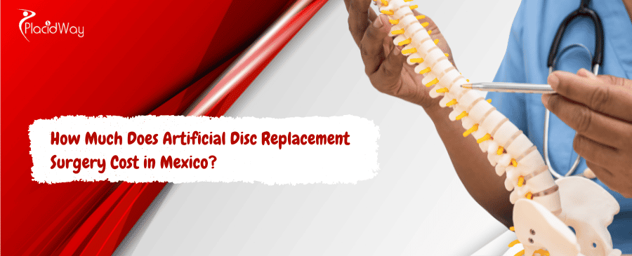 Artificial Disc Replacement Surgery Cost in Mexico