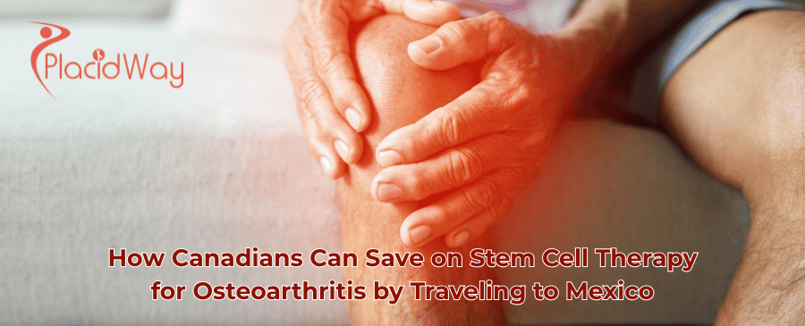 Terapia con células madre en México