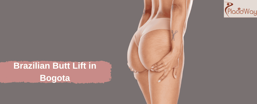 Levantamiento de glúteos brasileño en Bogotá