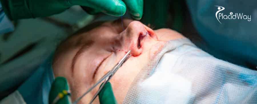 Rhinoplasty in South Korea