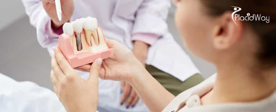Dental Implants in Vietnam