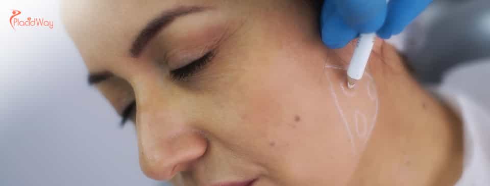 Jawline Contouring in South Korea