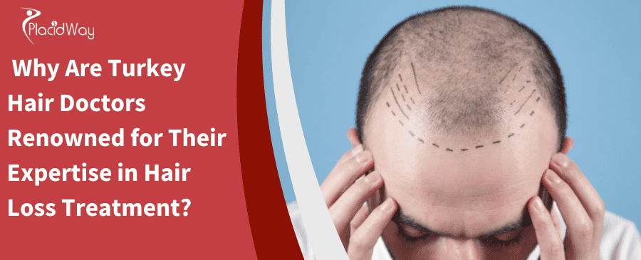 Why Are Turkey Hair Doctors Renowned for Their Expertise in Hair Loss Treatment
