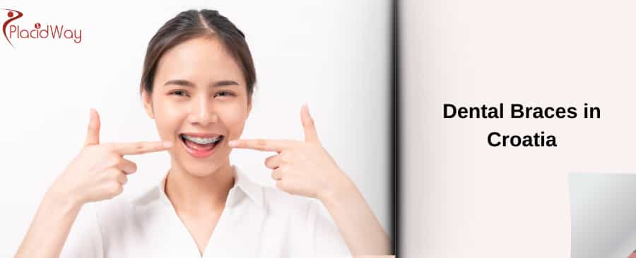 Dental Braces in Croatia