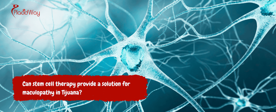 Can Stem Cell Therapy Provide A Solution For Maculopathy In Tijuana
