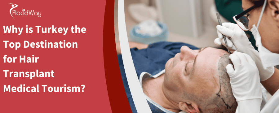 Why Is Turkey The Top Destination For Hair Transplant Medical Tourism