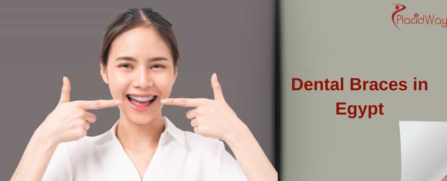Dental Braces in Egypt
