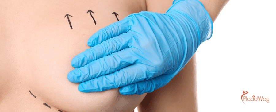 Breast Augmentation in Turkey