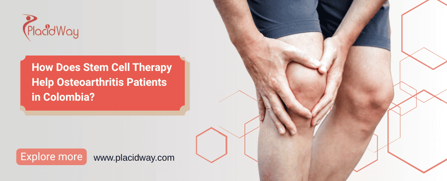 How Does Stem Cell Therapy Help Osteoarthritis Patients in Colombia