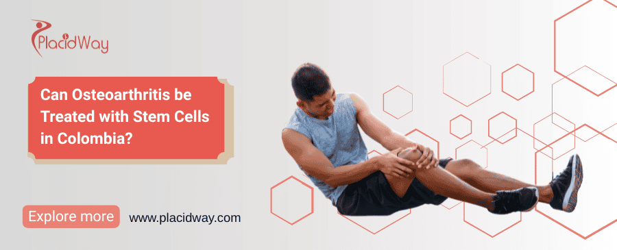 Can Osteoarthritis be Treated with Stem Cells in Colombia