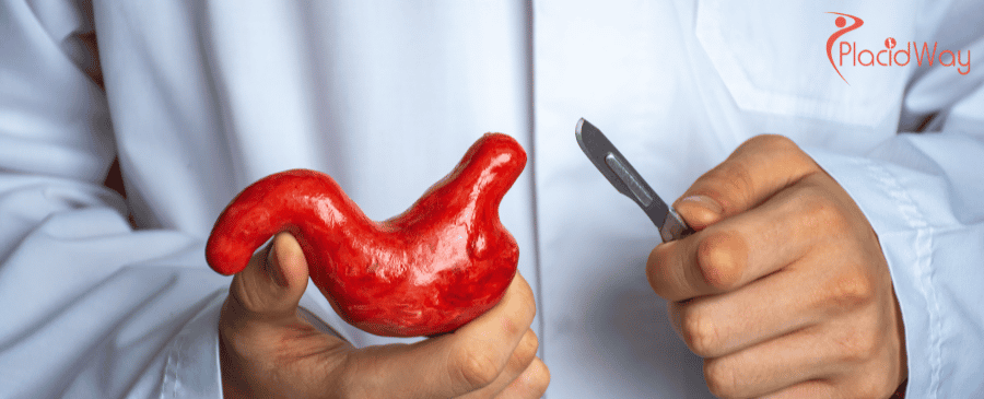 Gastric Sleeve Surgery in Turkey