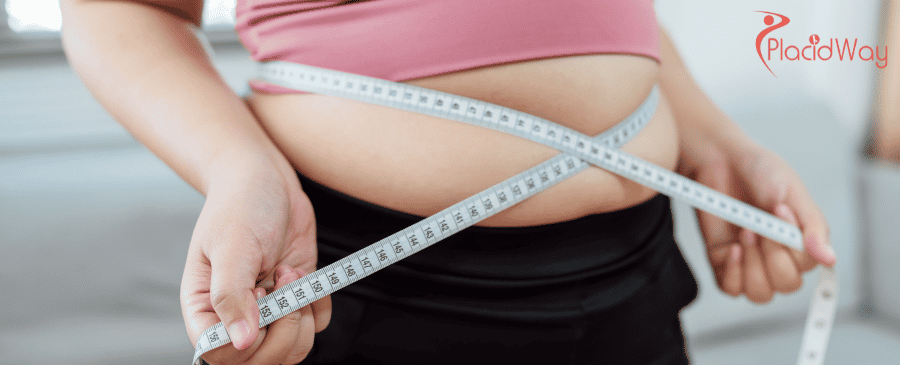 Gastric Sleeve Surgery in Turkey