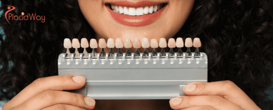 Veneers in Turkey, Porcelain Veneers in Turkey