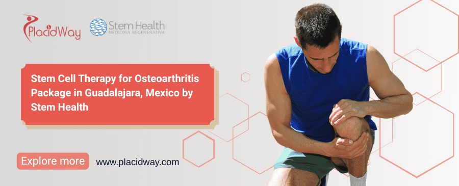 Stem Cell Guadalajara Mexico for Osteoarthritis