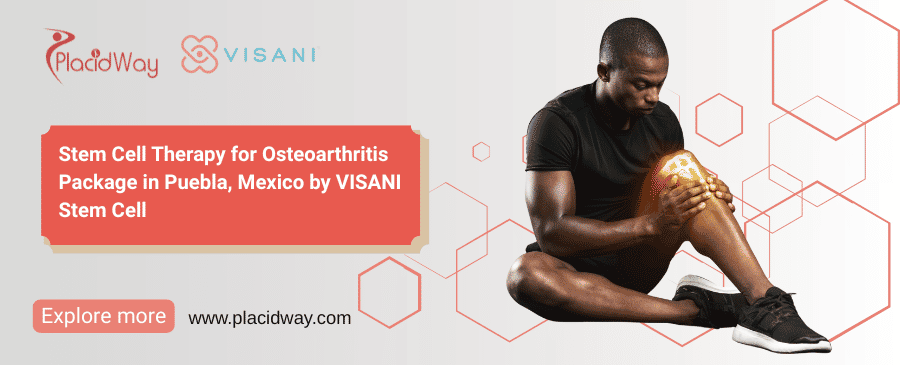 Stem Cell Treatment Mexico Cost for Osteoarthritis by VISANI