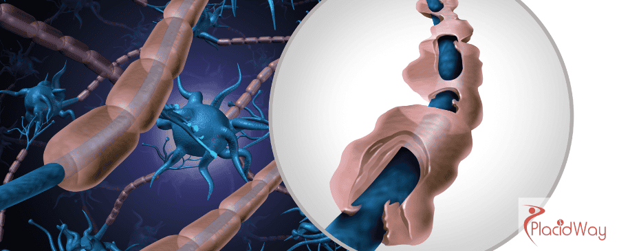 Stem Cell Therapy in Mexico
