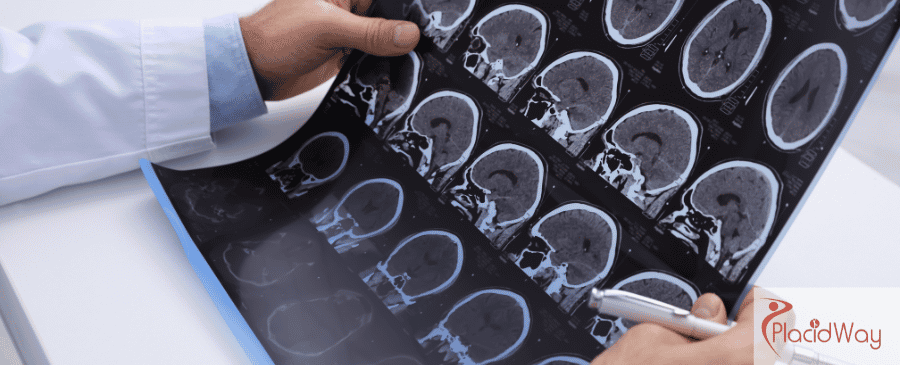 Stem Cell Therapy in Mexico