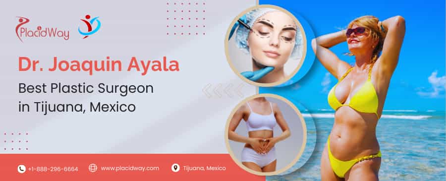 Dr. Joaquín Ayala - El mejor cirujano plástico de Tijuana, México