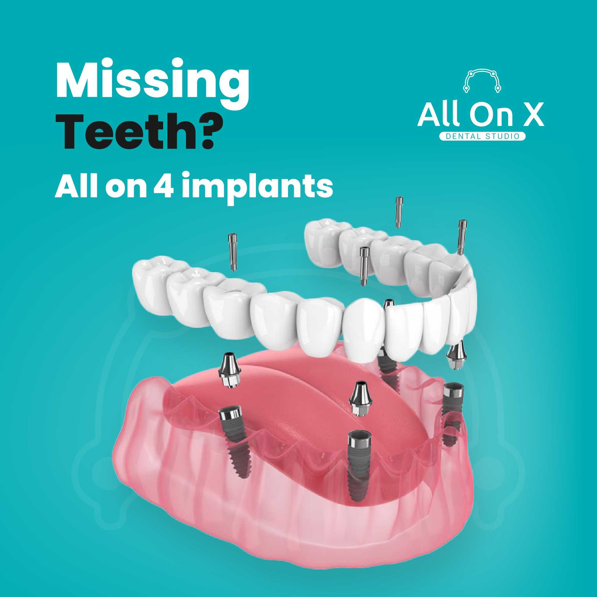 smile restoration Los Algodones Mexico