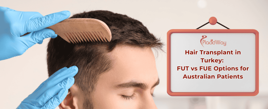 hair transplant in Turkey