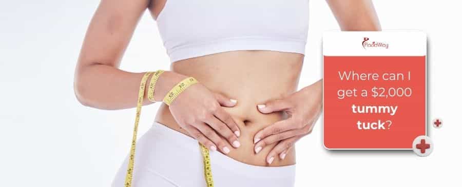 Tummy tuck